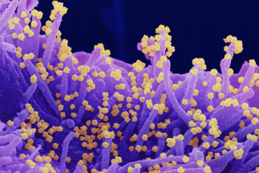 Las misteriosas mutaciones que hacen de delta la variante del virus de covid más contagiosa hasta ahora