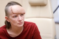 Para pacientes de cáncer sin seguro, conseguir atención médica es una lotería