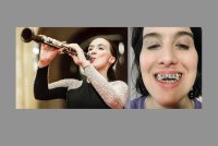 Este dispositivo dental debía arreglar las mandíbulas de los pacientes. Las demandas afirman que les destrozó los dientes