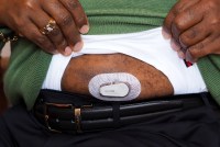 Montana May Require Insurers to Cover Monitoring Devices for Diabetes