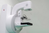 Mamografías que usan inteligencia artificial cuestan dinero extra… pero, ¿vale la pena?