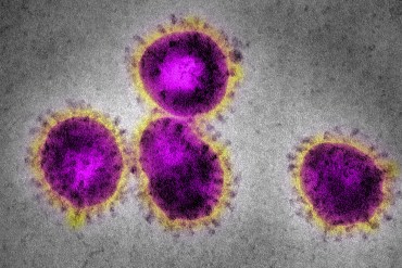 New California Coronavirus Case Reveals Problems with U.S. Testing Protocols