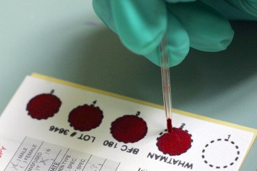 Southern States’ Lackluster Monkeypox Efforts Leave LGBTQ+ Groups Going It Alone