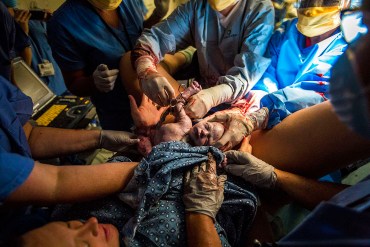Eclipsada por los opioides, regresa la metanfetamina y aumentan las urgencias