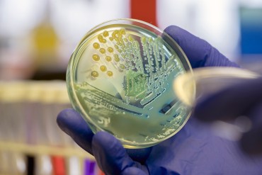 Manteniéndose vivo: cómo combatir la adicción a los opioides