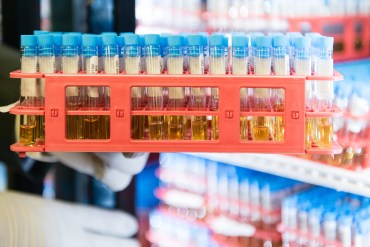 Alergia a la leche, una pesadilla médica… y financiera
