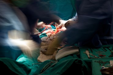 Cuando el cirujano opera a dos pacientes a la vez… en distintos quirófanos