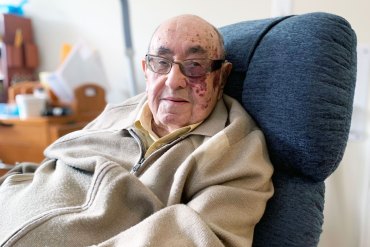 Assisted Living Facilities Pressed to Address Growing Needs of Older, Sicker Residents