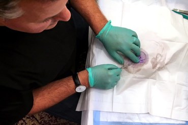 Zika Is ‘Game-Changer’ For OB-GYN Doctors In Florida